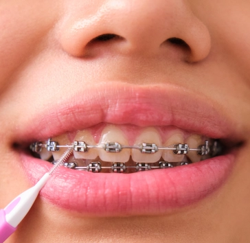 Read more about the article Leading Orthodontist In Great Neck